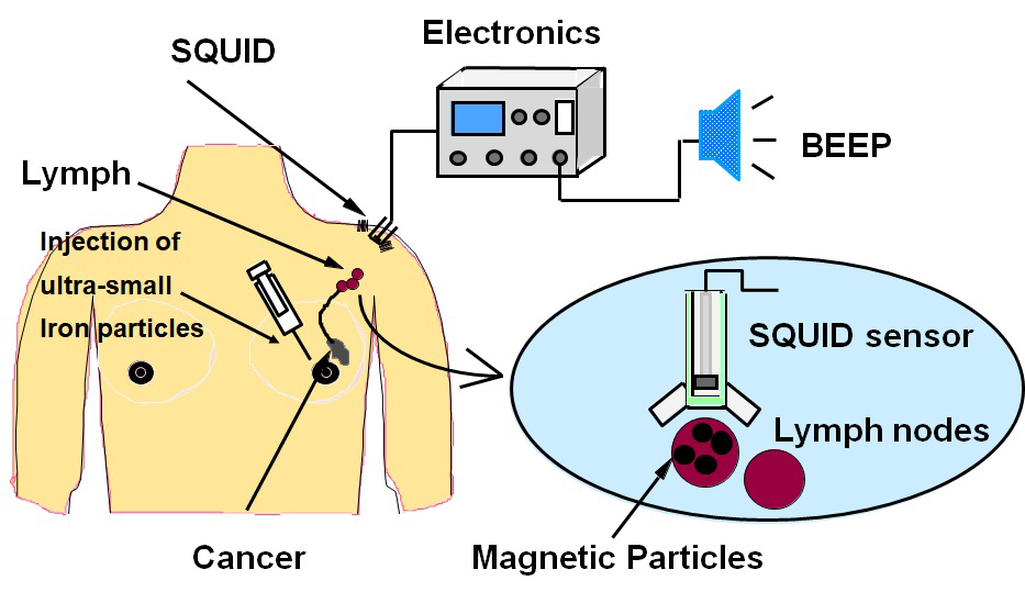 センチネルリンパ節の検査装置